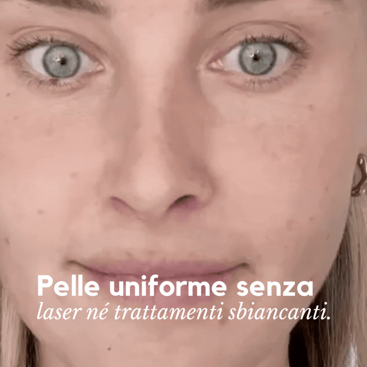 DarkSpot® Crema Antimacchie – Cancella e Rivela