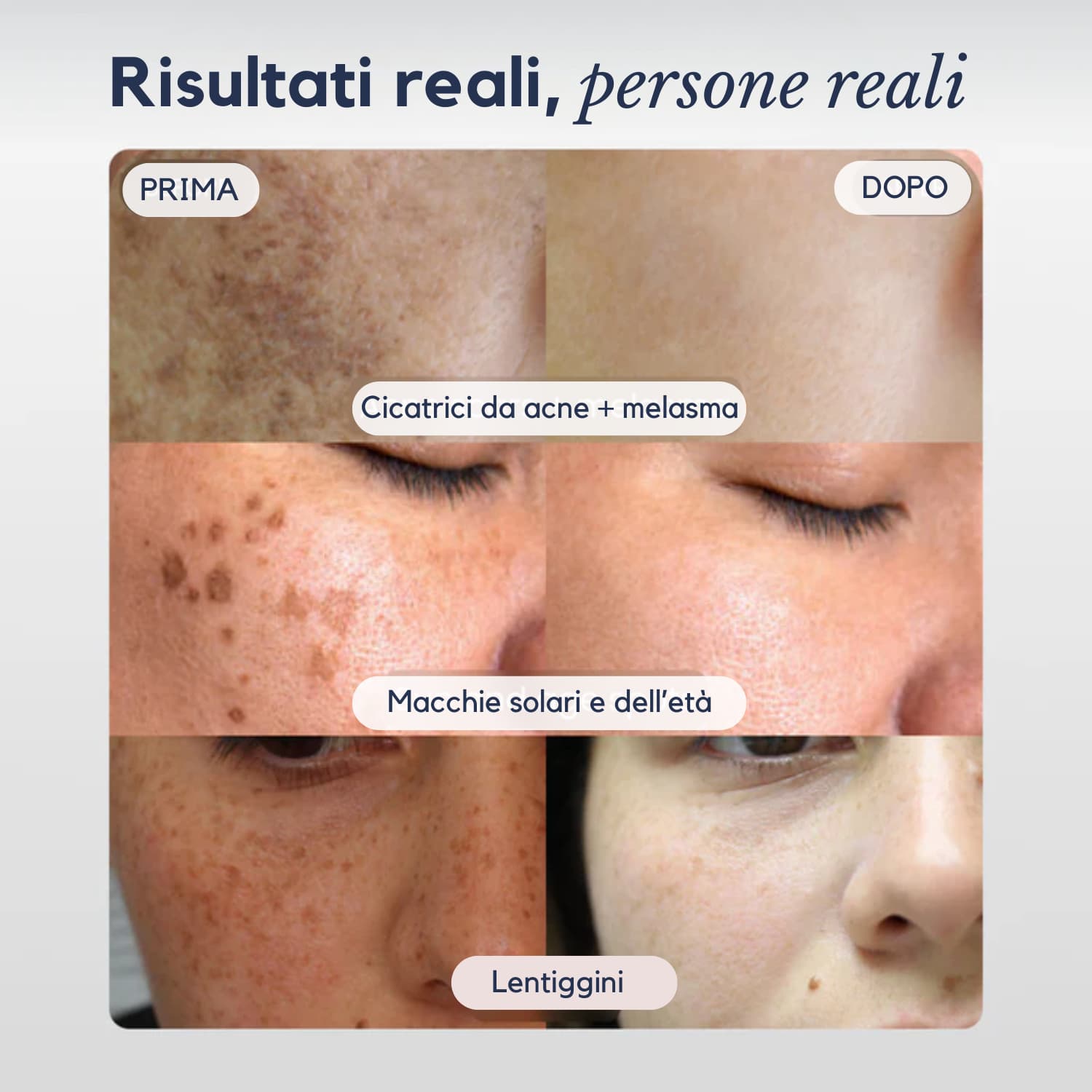 DarkSpot® Crema Antimacchie – Cancella e Rivela