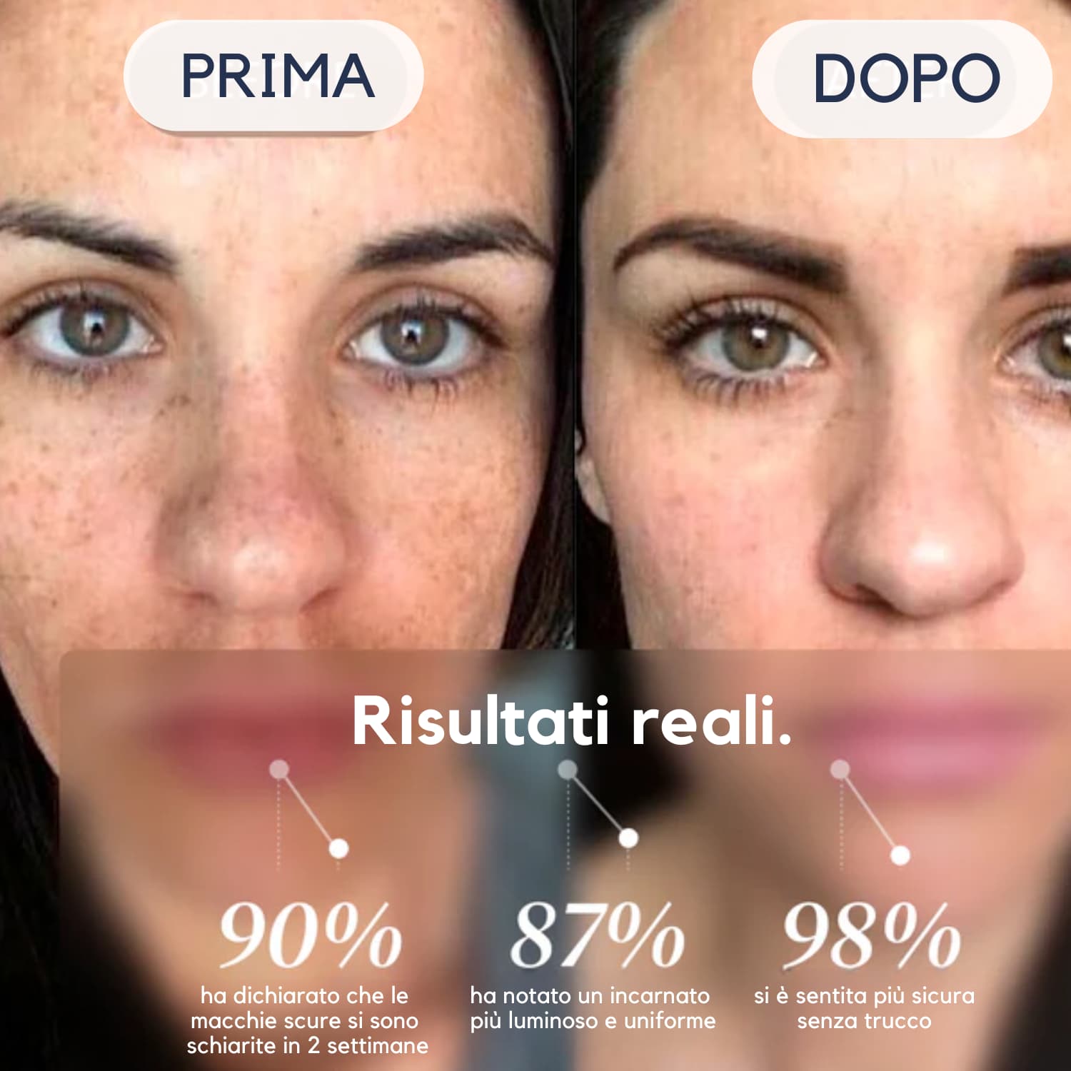 DarkSpot® Crema Antimacchie – Cancella e Rivela